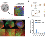 Using cerebral organoids as neuroinflammation models