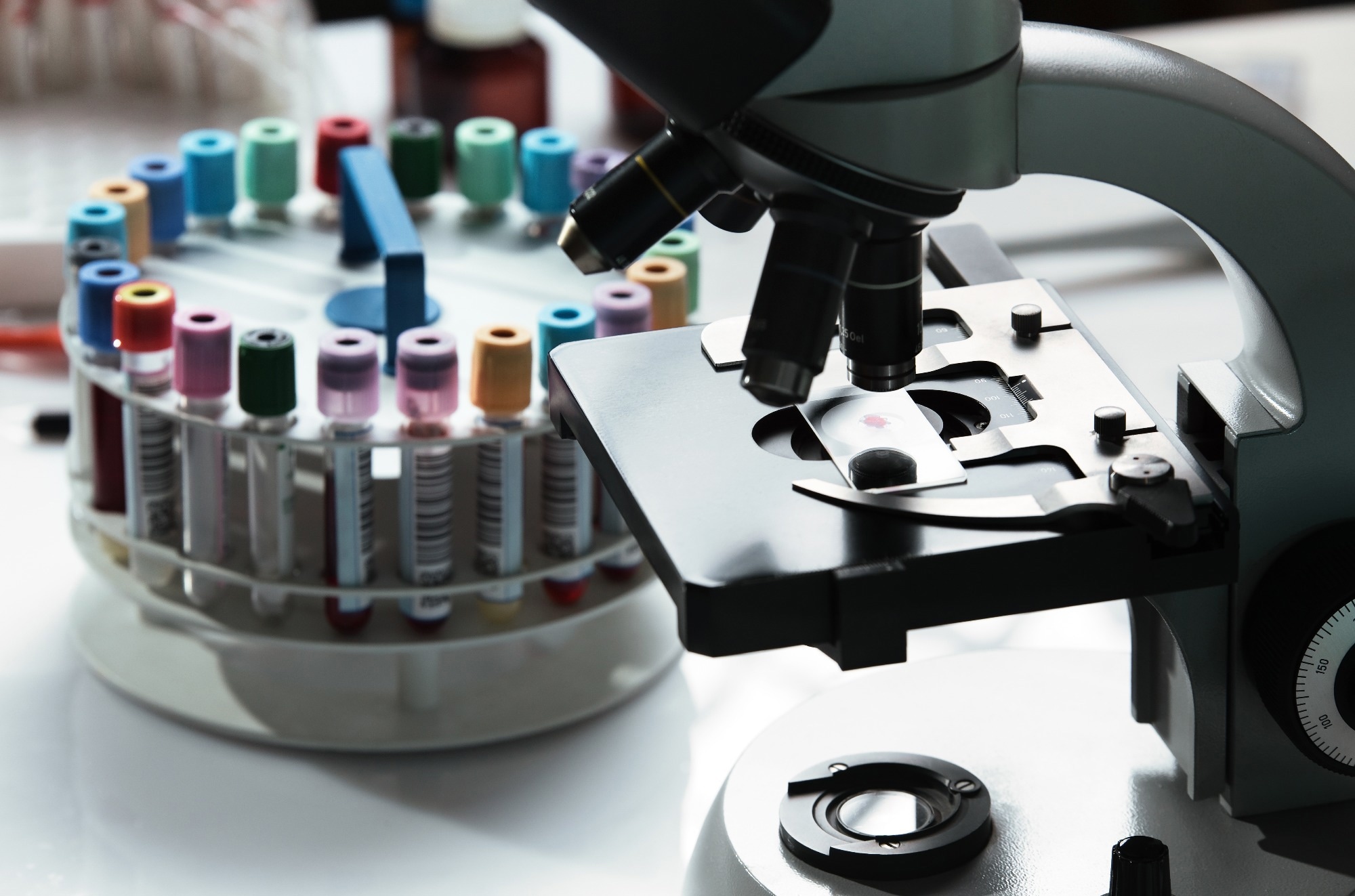 laboratory work table with a microscope and blood samples / workbench of laboratory and microscope with a blood sample on the slide