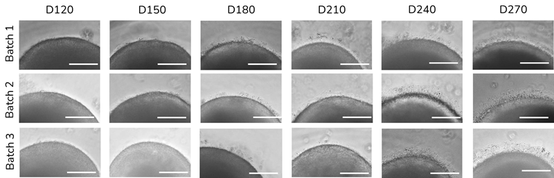 Over maturing timepoints POS increase in number, density and length. (A) Representative brightfield images of RO POS across 3 biological repeats. Scale bar 150 μm
