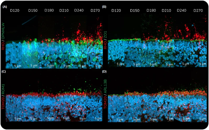 POS increase in presence and length over maturing time points at the protein level.