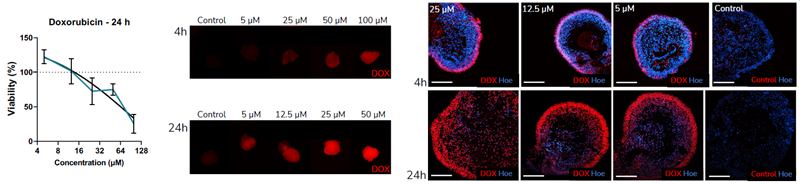 D. Retinal organoids were assessed for their suitability for studies with small molecules. In order to test whether small molecules penetrate the organoids, doxorubicin was used as a test compound. The intrinsic fluorescence of doxorubicin facilitates visualization of the drug penetration. Exposure of the iPSC-derived retinal organoids to doxorubicin reduced cell viability in a dose-dependent manner. Immunofluorescence analysis showed that doxorubicin penetrates the organoids after 4 and 24 h incubation.