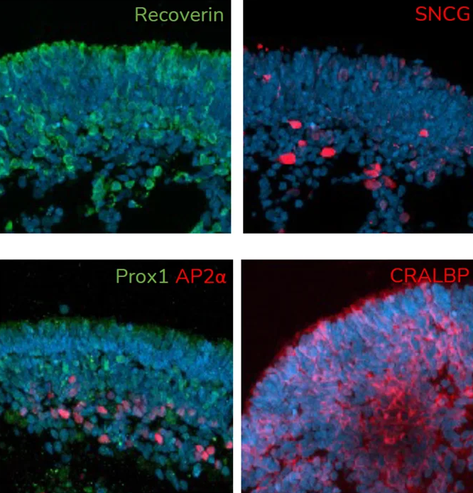 A. At day 150 of differentiation, retinal organoids contain major retinal cell types, including photoreceptors (Recoverin), retinal ganglion cells (SNCG), amacrine cells (AP2α), horizontal cells (Prox1) and Muller glia (CRALBP).