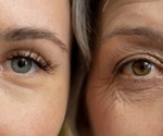 Is Cellular Senescence the Real Cause of Aging?