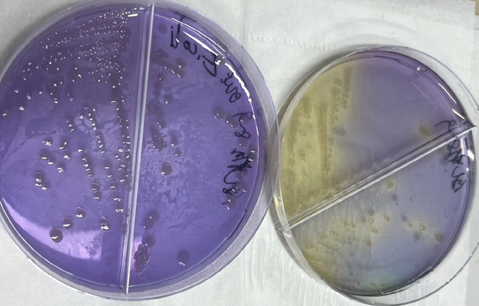 Lactose broth Agar with E. coli in ambient (left), in hypoxic chamber (right). Significant color changes due to pH change were observed in agar with E. coli grown in anerobic conditions