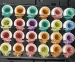 Streamline screening using automated microbial plating