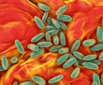 Why Is Plague Still a Threat? Historical Lessons and Future Preparedness