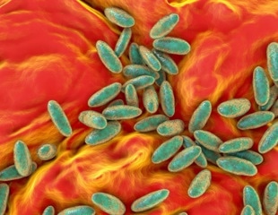 Why Is Plague Still a Threat? Historical Lessons and Future Preparedness