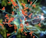 What is Autoimmunity?