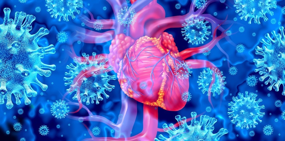 Myocarditis