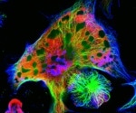 What is Neuroblastoma?