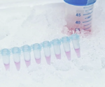 Temperature Control and Heat Exchange in Bioreactors