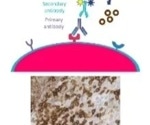 How to integrate IHC biomarkers for effective clinical development in immuno-oncology