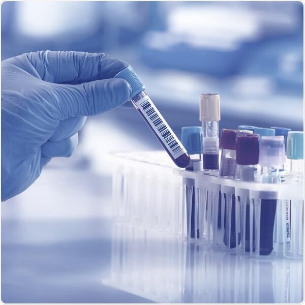 Cerba Research offers state-of-the-art in-vitro diagnostics Cerba Research offers state-of-the-art in-vitro diagnostics