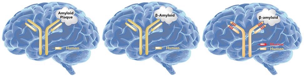 Discussing major hypotheses of Alzheimer’s disease