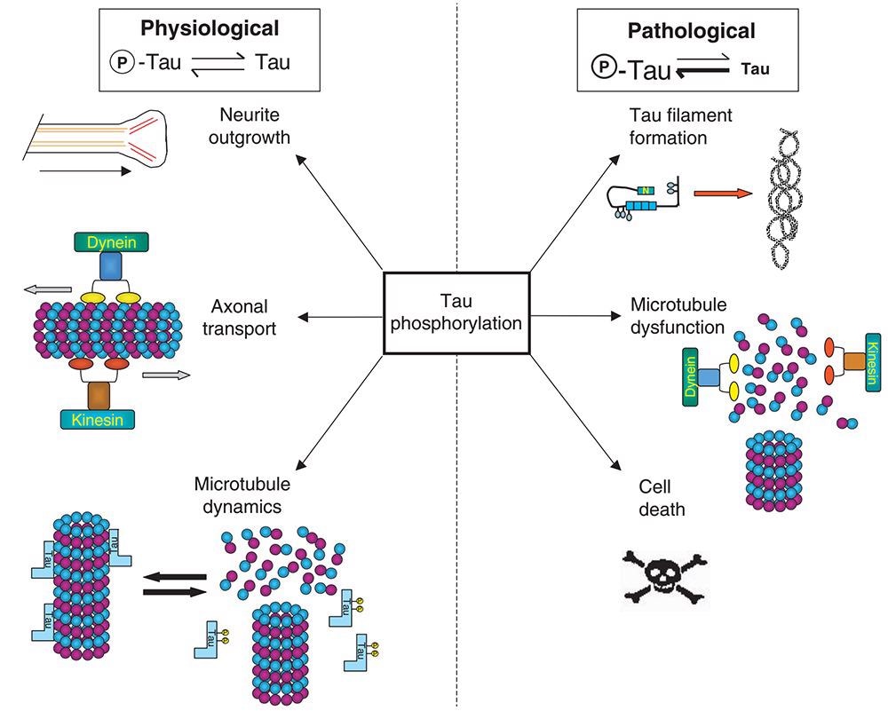 Discussing major hypotheses of Alzheimer’s disease