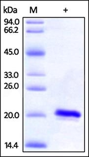 The pathology and epidemiology of Amyotrophic Lateral Sclerosis (ALS)