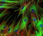 In-depth analysis of T cells in CRLM with TissueFAXS Chroma and StrataQuest