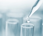Whether to use manual or electronic pipettes