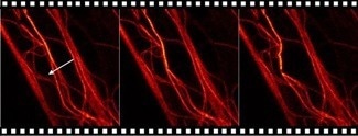 AFM in living cell experiments