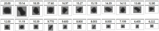 Quality control of medical ceramics through particle size analysis