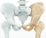 Quality control of medical ceramics through particle size analysis