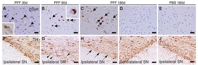 Pre-formed fibrils (PFFs) and the modelling of neurodegenerative diseases
