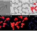 Using Amira Software to Measure 3D Organelle Morphology