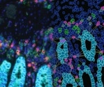 Transcript and protein level immune-checkpoint analysis of glioma