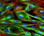 Studying Actin Waves Using Cryo-Electron Tomography