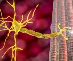 Leading the way in Myasthenia Gravis (MG) detection
