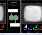 How to accelerate the development of in vitro models of chemoresistance?