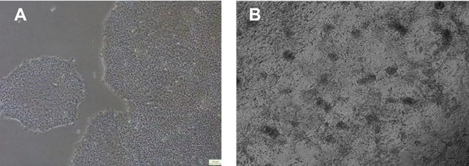 Differentiation and expansion of (a) induced pluripotent stem cells (iPSCs) into (b) myocardial cell precursors after induction.