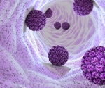 The role of type I interferon and CD8+ T cell detection in rectal adenocarcinoma prediction
