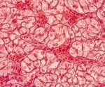 How tissue engineering and regenerative medicine use bioprinting