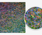 How are in vitro lung models propelling drug discovery?