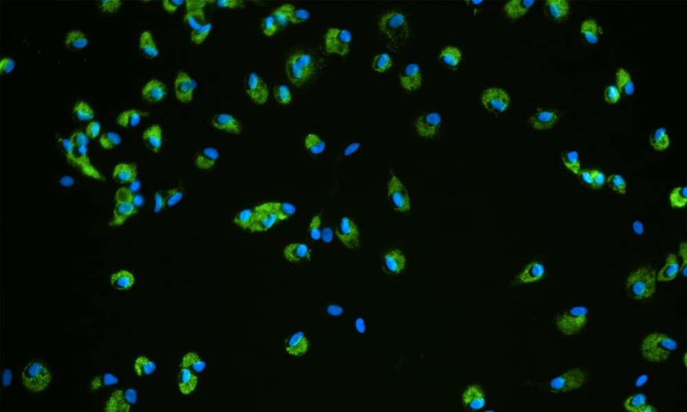What are the sub-types of drug-induced liver injury (DILI)?