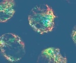 What are the sub-types of drug-induced liver injury (DILI)?