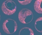 How a liver-on-a-chip model of fatty liver disease could assist in preventing a global healthcare crisis