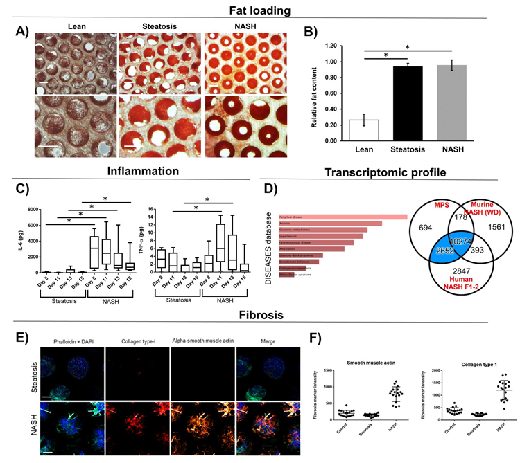 Liver MPS microtissues loaded with fat display NASH phenotype. PHH, HK and HSC were culture in the liver MPS in either lean or fat conditions. Steatosis controls contained 10-fold less HK and HSC than NASH co-cultures. Microtissues analyzed for A + B) Fat loading via quantified Oil Red O staining. C) Inflammatory biomarkers were measured in cell culture medium; D) Transcriptomic profile of NASH microtissues was analyzed via DISEASEs database and compared to profile of human NASH biopsy samples and western diet ( NASH mice - numbers highlight number of overlapping DEGs. E) Fibrosis was measured and quantified using high content confocal microscopy. Microtissues were imaged (representative images shown) and F) images quantified. All scale bars 300 µm. Data are mean ± SD, n = minimum 6. * = P < 0.05.