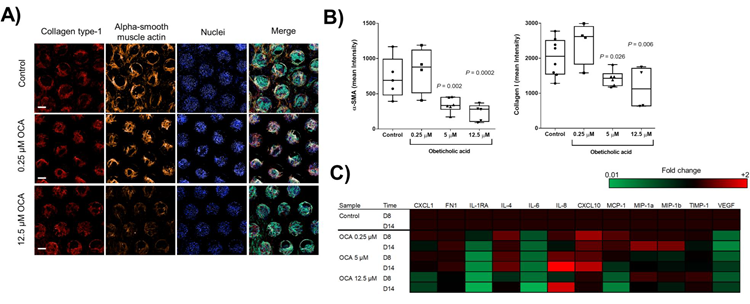 OCA treatment of liver MPS microtissues reduces NASH phenotype. Liver microtissues were cultured in the Liver MPS for 15 days and after 4 days cultures were dosed daily with the FXR agonist OCA or vehicle 0 1% DMSO). A) Confocal microscopy images of microtissues from each condition at the end of study (representative images shown). For each scaffold 8 regions of interest acquired and each biological condition has