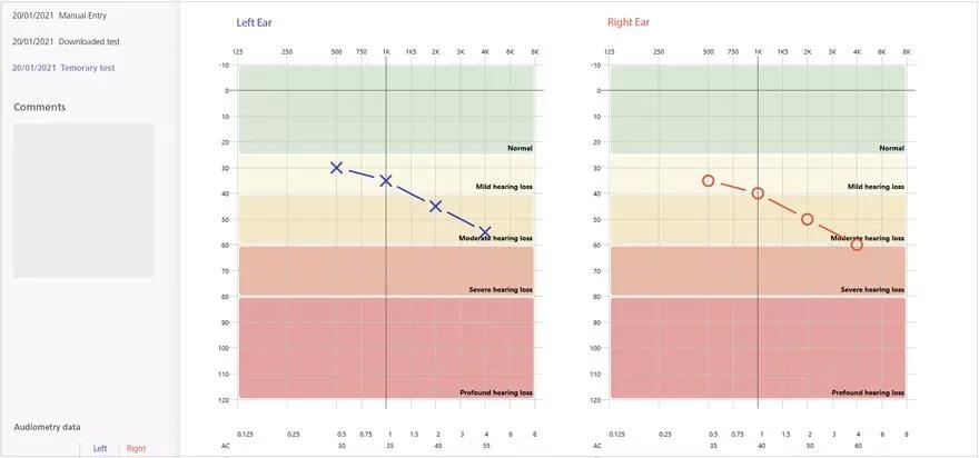 Understanding the Hughson Westlake hearing test: Procedure and best practices