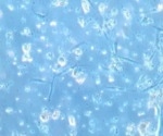 Fresh human tissue collection for accelerated research