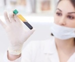 What differentiates a buffy coat from PBMCs?