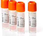 Extraction of tumor-infiltrating lymphocytes from DTCs