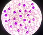 What are the sources of red blood cell contamination?