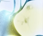 How to measure p-Tau 181 assays