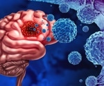 Tumor-Associated Macrophages and Adrenomedullin Targeting to Enhance Glioblastoma Treatment Outcomes