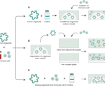 Advanced co-culture systems: Enhancing cancer research with organoid-immune models