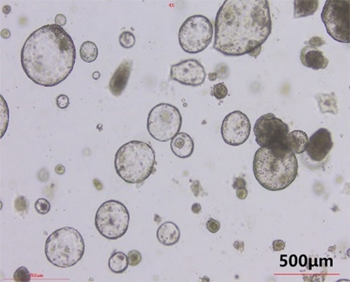 EGF (Cat. No. EGF-H52H3), Noggin (Cat. No. NON-H5257), R-spondin1 (Cat. No. RS6-H4220), maintain colonic organoid growth well during multiple passages and long-term culture processes