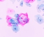 Precision spectroscopy: Revolutionizing tissue identification in medical diagnostics